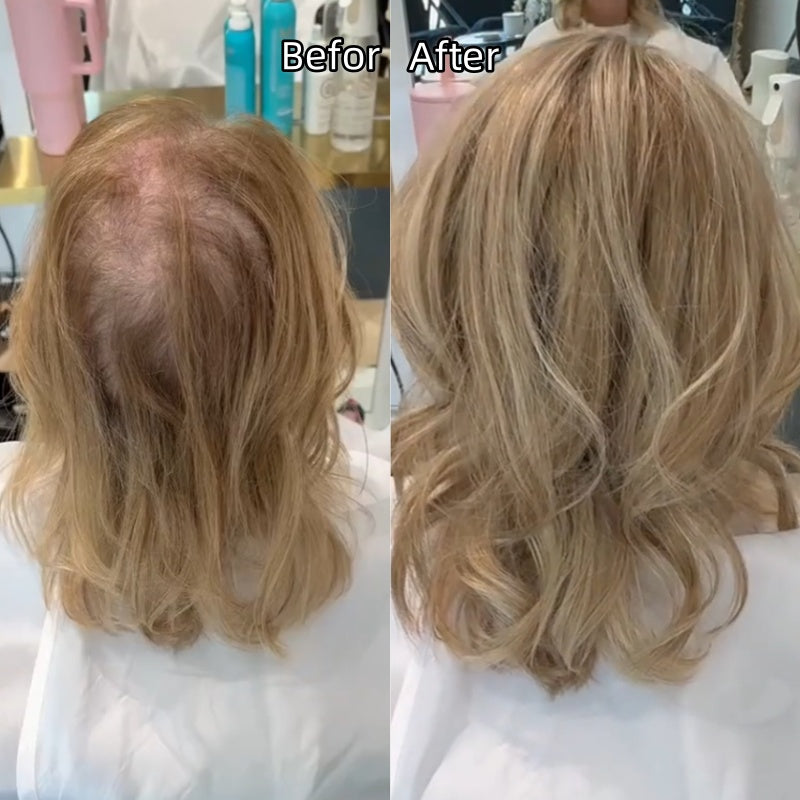 ⏰ Final Hours –✨2026 New Lightweight & Breathable Wavy Hair Topper